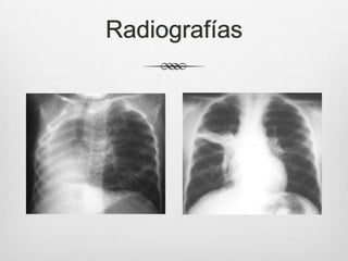 Radiografías
 