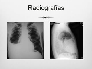 Radiografías
 