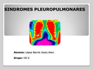 SINDROMES PLEUROPULMONARES




   Alumno: López Barret Jesús Alexi

   Grupo: VII-2
 