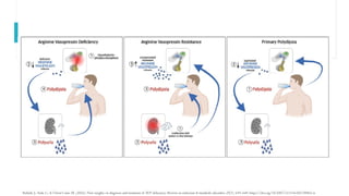 Polyu Ricri Comprehensive Overview of Polyuric Syndromes: Pathophysiology ...