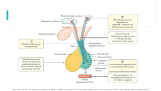 Polyu Ricri Comprehensive Overview of Polyuric Syndromes: Pathophysiology ...