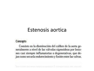 Estenosis aortica
 