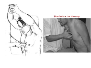 Maniobra de Harvey
 