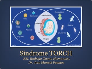 Síndrome TORCH
EM. Rodrigo Gaona Hernández.
Dr. Jose Manuel Fuentes

 