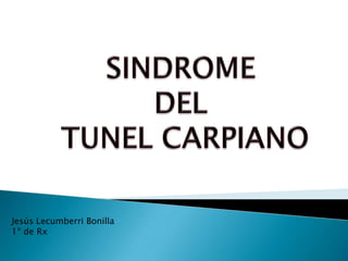 Sindrome tunel carpiano