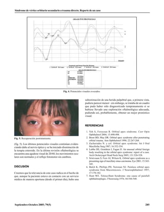 Síndrome de vértice orbitario secundario a trauma directo. Reporte de un caso




                                             Fig. 4. Potenciales visuales evocados.


                                                                   subestimación de una herida palpebral que, a primera vista,
                                                                   pudiera parecer menor~ sin embargo, se trataba de un cuadro
                                                                   que pudo haber sido diagnosticado tempranamente si se
                                                                   hubiese llevado una exploración oftalmológica adecuada,
                                                                   pudiendo así, probablemente, obtener un mejor pronóstico
                                                                   visual.


                                                                   REFERENCIAS

                                                                    1. Yeh S, Foroozan R. Orbital apex síndrome. Curr Opin
                                                                       Ophthalmol 2004; 15:490-498.
Fig. 5. Recuperación postratamiento.                                2. Brent BD, May DR. Orbital apex syndrome after penetrating
                                                                       orbital trauma. Ann Ophthalmol 1990; 22:267-268.
(fig. 5). Los últimos potenciales visuales continúan eviden-        3. Zachariades N. y col. Orbital apex syndrome. Int J Oral
ciando daño al nervio óptico y se ha iniciado disminución de           Maxillofac Surg 1987; 16:352-354.
                                                                    4. Lubbe DE, Grardnier I, Fagan JJ. An unusual orbital foreign
la terapia esteroide. En la última revisión oftalmológica se
                                                                       body resulting in the orbital apex syndrome: report of a case.
encuentra una agudeza visual de 20/60, los movimientos ocu-
                                                                       Arch Otolaryngol Head Neck Surg 2005; 131:526-528.
lares son normales y el reflejo fotomotor sin cambios.              5. Srinivasan S, Fern AI, Wilson K. Orbital apex syndrome as a
                                                                       presenting sign of maxillary sinus carcinoma. Eye 2001; 15:343-
                                                                       345.
DISCUSIÓN                                                           6. Balch K, Phillips PH, Newman NJ. Painless orbital apex
                                                                       syndrome from Mucormicosis. J Neuroophthalmol 1997;
Creemos que la relevancia de este caso radica en el hecho de           17:178-182.
que, aunque la paciente estuvo en contacto con un servicio          7. Hunt WE. Tolosa-Hunt Syndrome: one cause of painfull
médico de manera oportuna (desde el primer día), hubo una              ophthalmoplegia. J Neurosurg 1976; 44:544-548.




Septiembre-Octubre 2005; 79(5)                                                                                                   285
 