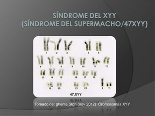 Sindrome xyy | PPTX