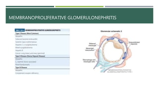 MEMBRANOPROLIFERATIVE GLOMERULONEPHRITIS
 