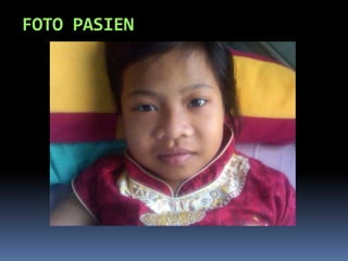 FOTO PASIEN
 