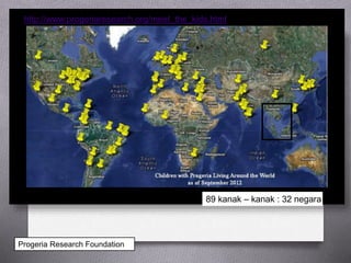 Progeria Research Foundation
http://www.progeriaresearch.org/meet_the_kids.html
89 kanak – kanak : 32 negara
 
