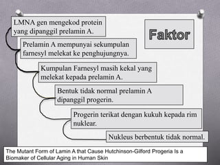 LMNA gen mengekod protein
yang dipanggil prelamin A.
Prelamin A mempunyai sekumpulan
farnesyl melekat ke penghujungnya.
Kumpulan Farnesyl masih kekal yang
melekat kepada prelamin A.
Bentuk tidak normal prelamin A
dipanggil progerin.
Progerin terikat dengan kukuh kepada rim
nuklear.
Nukleus berbentuk tidak normal.
The Mutant Form of Lamin A that Cause Hutchinson-Gilford Progeria Is a
Biomaker of Cellular Aging in Human Skin
 