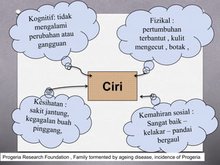 Ciri
Fizikal :
pertumbuhan
terbantut , kulit
mengecut , botak ,
Progeria Research Foundation , Family tormented by ageing disease, incidence of Progeria
 