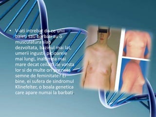 • V-ati intrebat de ce unii
baieti sau barbati au o
musculatura slab
dezvoltata, bazinul mai lat,
umerii ingusti, picioarele
mai lungi, inaltimea mai
mare decat ceilalti de varsta
lor si de multe ori prezinta
semne de feminitate? Ei
bine, ei sufera de sindromul
Klinefelter, o boala genetica
care apare numai la barbati.
 