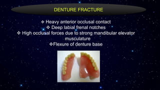  Heavy anterior occlusal contact
 Deep labial frenal notches
 High occlusal forces due to strong mandibular elevator
musculature
Flexure of denture base
DENTURE FRACTURE
 