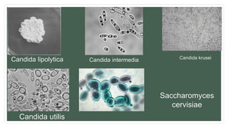 Candida lipolytica Candida krusei
Candida intermedia
Candida utilis
Saccharomyces
cervisiae
 