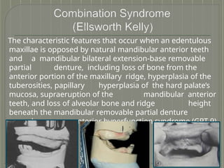 singlecompletedenture-200609151456 (1).pptx