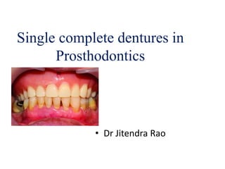 Single complete dentures in
Prosthodontics
• Dr Jitendra Rao
 