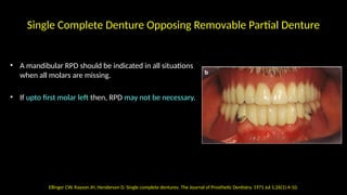 Sindle Rpd Single Complete Denture.pptx - combination syndrome | PPTX