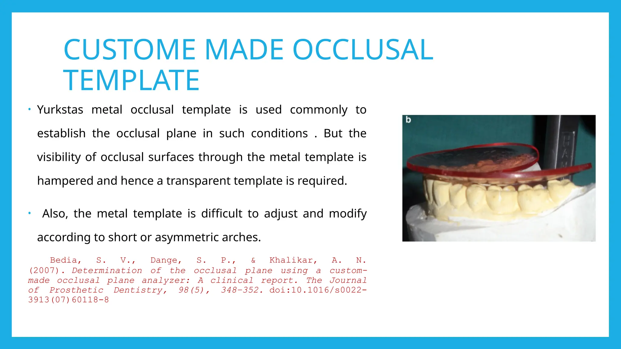 SINGLE COMPLETE DENTURES sam [Autosaved] (1).pptx