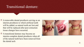 Transitional Teeth Comprehensive Guide to Immediate and Single Dentures in Prosthodontics ...