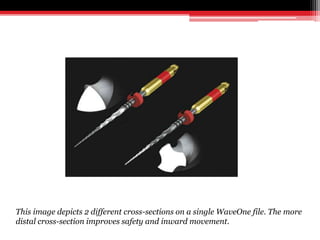 This image depicts 2 different cross-sections on a single WaveOne file. The more
distal cross-section improves safety and inward movement.
 