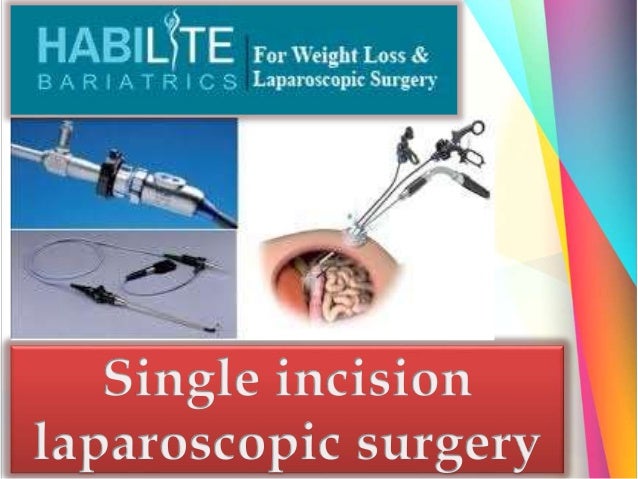 Best Gallbladder surgery in Delhi | Single incision laparoscopic surg…