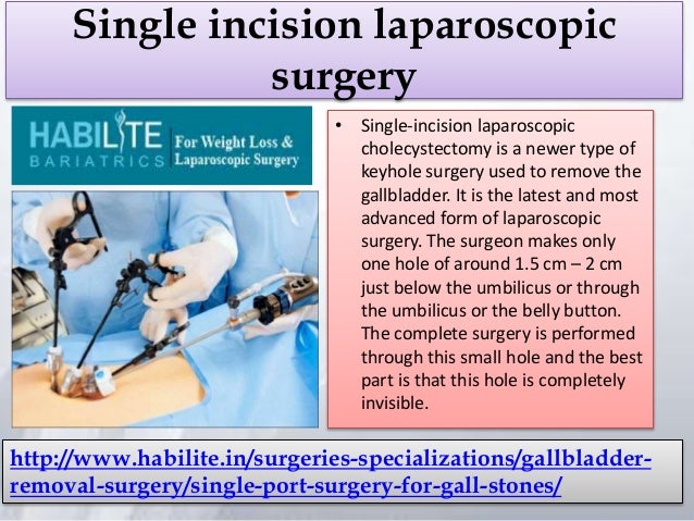 Best Gallbladder surgery in Delhi Single incision