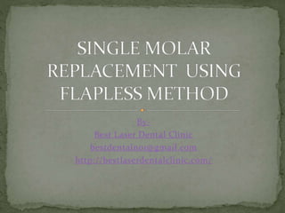 By-
Best Laser Dental Clinic
bestdentalno1@gmail.com
http://bestlaserdentalclinic.com/
 