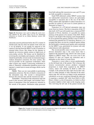 Single photon emission computed tomography spect | PDF