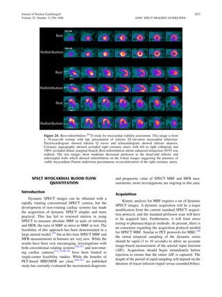 Spect Rapid Rotation Single photon emission computed tomography spect | PDF