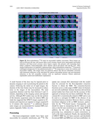Normal Frame Spect Single photon emission computed tomography spect | PDF