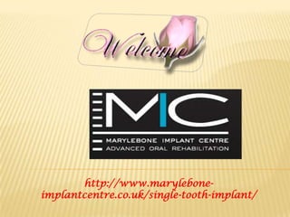 http://www.marylebone-
implantcentre.co.uk/single-tooth-implant/
 