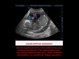COLOR DOPPLER ASSESMENTAltered  dopplerparametres in the umbilical artery may be sequael to large size of the single umbilical artery  and  reduced resistance in the same .  IUGR , associated abnormalities  can  also alter the  dopplerassesment.