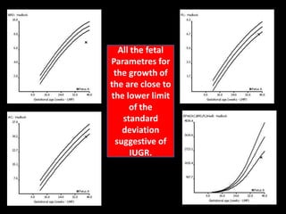 All the fetalParametres for the growth of the are close to the lower limit of the  standard deviation suggestive of IUGR.  