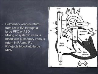 Pulmonary venous return
from LA to RA through a
large PFO or ASD
Mixing of systemic venous
blood with pulmonary venous
return in RA and RV
RV ejects blood into large
MPA
 