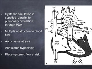 Systemic circulation is
supplied parallel to
pulmonary circulation
through PDA
Multiple obstruction to blood
flow
- Aortic valve atresia
- Aortic arch hypoplasia
- Place systemic flow at risk
 