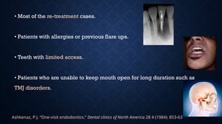 • Most of the re-treatment cases.
• Patients with allergies or previous flare ups.
• Teeth with limited access.
• Patients who are unable to keep mouth open for long duration such as
TMJ disorders.
Ashkenaz, P J. “One-visit endodontics.” Dental clinics of North America 28 4 (1984): 853-63 .
 