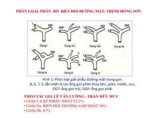 PHÂN LOAI, PHÂN BỐ BiẾN ĐỔI ĐƢỜNG MẬT: TRỊNH HỒNG SƠN




               Hình 1: Phân loại giải phẫu đường mật trong gan.
     B, G, T, S: lần lượt là các ống gan phân thùy bên, giữa, trước, sau;
                      OGT: ống gan trái, OGP: ống gan phải
   THEO TÁC GIẢ LÊ VĂN CƢỜNG - TRẦN HỮU DUY:
   • LOẠI I: GẶP NHIỀU NHẤT 83,3%
   • LOẠI IIa: BIẾN ĐỔI THƯỜNG GẶP NHẤT 10%
   • LOẠI IIb: 67%
 