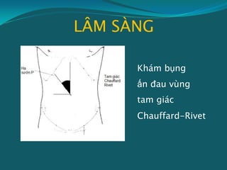 LÂM SÀNG
Khám bụng
ấn đau vùng
tam giác
Chauffard-Rivet
 