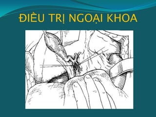 ĐIỀU TRỊ NGOẠI KHOA
 