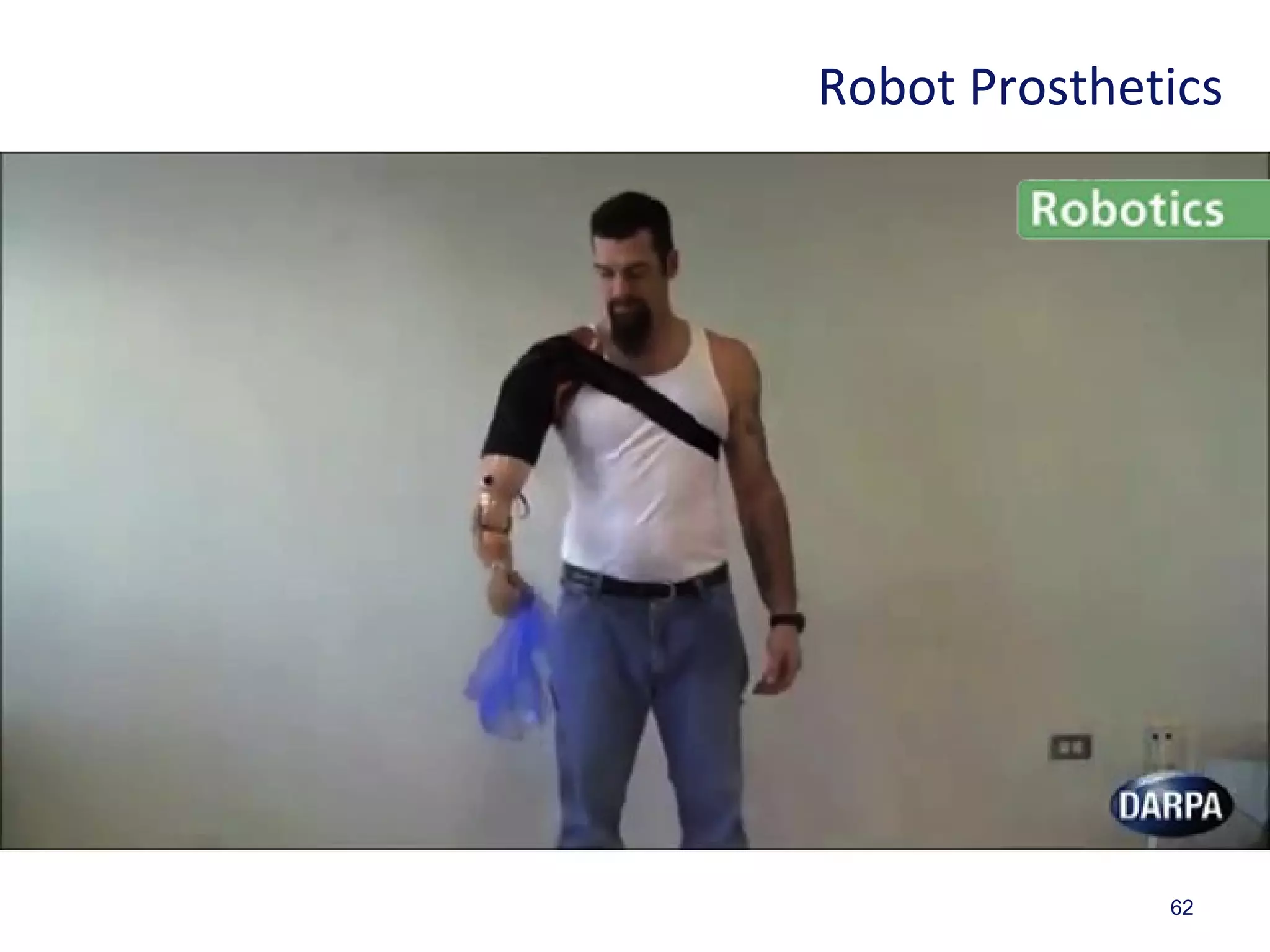 62
Robot Prosthetics
 