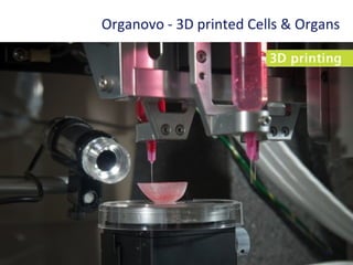 43
Organovo - 3D printed Cells & Organs
 