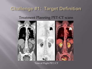 Treatment Planning PET-CT scans




        Time of Flight PET/CT
 