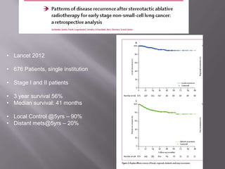 • Lancet 2012

• 676 Patients, single institution

• Stage I and II patients

• 3 year survival 56%
• Median survival: 41 months

• Local Control @5yrs – 90%
• Distant mets@5yrs – 20%
 