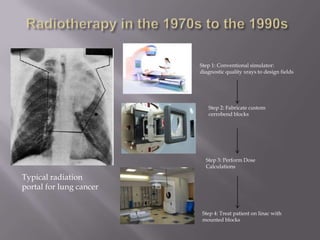 Step 1: Conventional simulator:
                         diagnostic quality xrays to design fields




                            Step 2: Fabricate custom
                            cerrobend blocks




                           Step 3: Perform Dose
                           Calculations

Typical radiation
portal for lung cancer


                          Step 4: Treat patient on linac with
                          mounted blocks
 