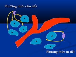 Ph ng th c c n ti tươ ứ ậ ếPh ng th c c n ti tươ ứ ậ ế
Phương thức tự tiếtPhương thức tự tiết
 