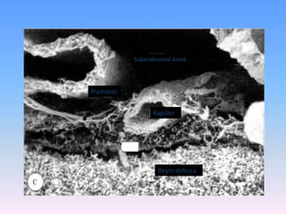 Subaraknoidal Aralık




Piamater.


                   Kapiller




                     Beyin dokusu
 