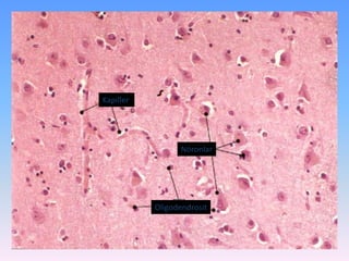 Kapiller




                 Nöronlar




           Oligodendrosit
 