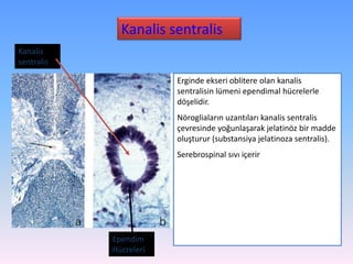 Kanalis sentralis
Kanalis
sentralis

                        Erginde ekseri oblitere olan kanalis
                        sentralisin lümeni ependimal hücrelerle
                        döşelidir.
                        Nörogliaların uzantıları kanalis sentralis
                        çevresinde yoğunlaşarak jelatinöz bir madde
                        oluşturur (substansiya jelatinoza sentralis).
                        Serebrospinal sıvı içerir




            Ependim
            Hücreleri
 