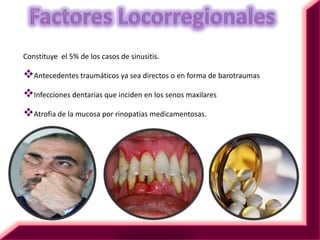 IntroducciónSe denomina sinusitis al cuadro que cursa con inflamación de la mucosa de los senos paranasales.